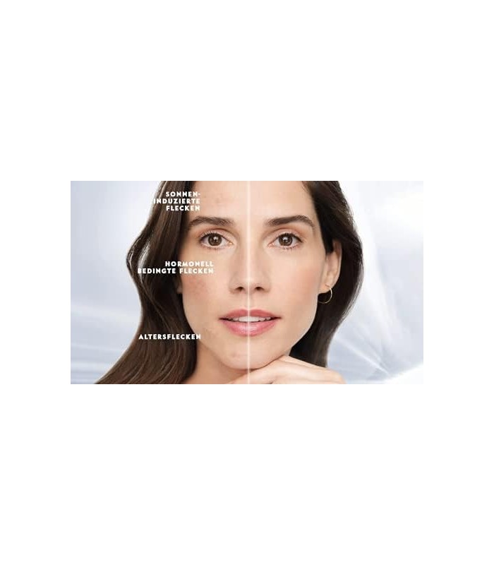 NIVEA Cellular Luminous630 Sérum Intensivo para Manchas (30 ml), Sérum para uma tez uniforme e radiante, cuidado do rosto contra