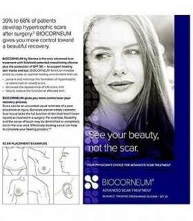 BioCorneum Scar Treatment Plus SPF 30 Silicone Scar Treatment 10 Gram da Sientra