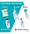 CeraVe Ácido Salicílico Tratamento da Acne com Ácido Glicólico e Ácido Láctico | Gel de Acne para Rosto para Controlar e Elimina